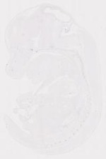 EMAGE:12039