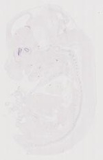 EMAGE:12039