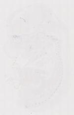 EMAGE:12039