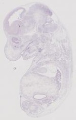EMAGE:12040
