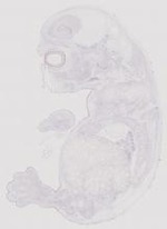 EMAGE:12040