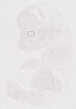 EMAGE:12041