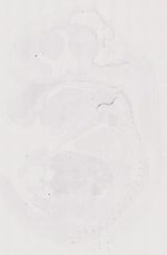 EMAGE:12041