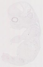 EMAGE:12043
