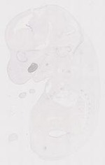 EMAGE:12043
