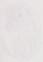 EMAGE:12043