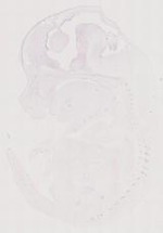 EMAGE:12043