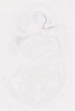 EMAGE:12043