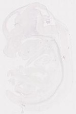 EMAGE:12043