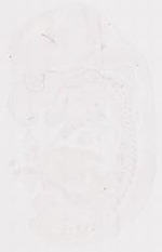 EMAGE:12043