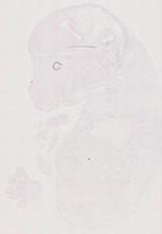EMAGE:12043