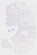 EMAGE:12058