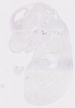 EMAGE:12058