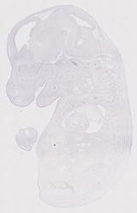 EMAGE:12058