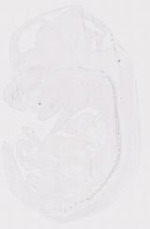 EMAGE:12058