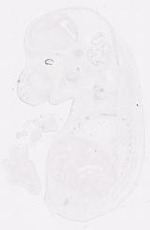EMAGE:12058
