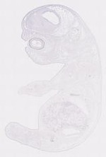 EMAGE:12059