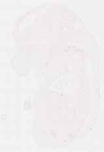 EMAGE:12061