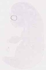 EMAGE:12063