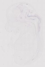 EMAGE:12093