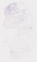 EMAGE:12101