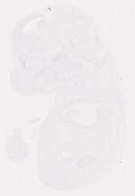 EMAGE:12135
