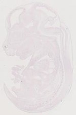 EMAGE:12141
