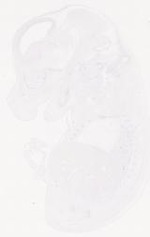 EMAGE:12144