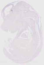 EMAGE:12149