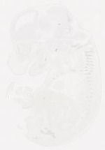 EMAGE:12155
