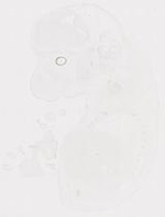 EMAGE:12155