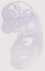 EMAGE:12156