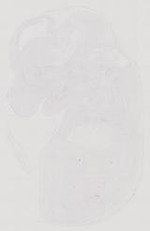 EMAGE:12156