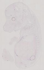 EMAGE:12174