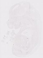 EMAGE:12179