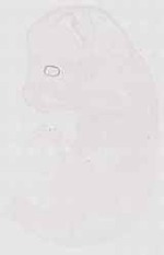 EMAGE:12388