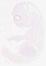 EMAGE:12411