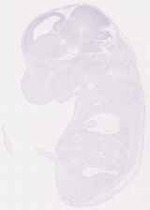 EMAGE:12418