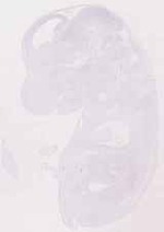 EMAGE:12418