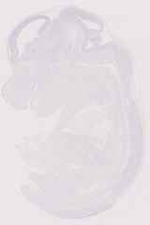 EMAGE:12418
