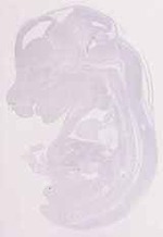 EMAGE:12418