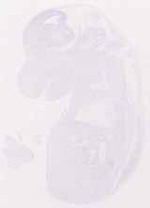 EMAGE:12418