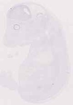 EMAGE:12418