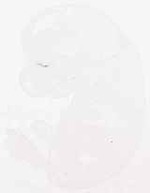 EMAGE:12427