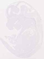 EMAGE:12464