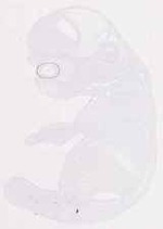 EMAGE:12467