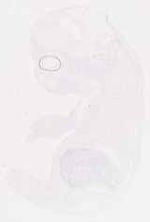 EMAGE:12491