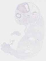EMAGE:12570