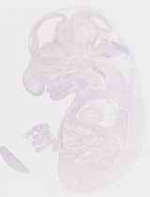 EMAGE:12574