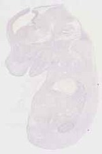 EMAGE:12667
